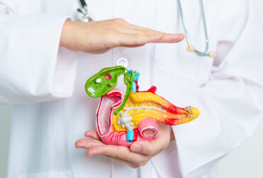 Pancreatic-cancer-PAGE-İMG1